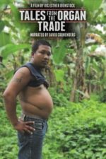 Tales from the Organ Trade (2013)