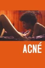 Nonton Film Acne (2008) Subtitle Indonesia Streaming Movie Download